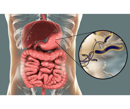 Helicobacter pylori: la bacteria silenciosa que millones tienen sin saberlo